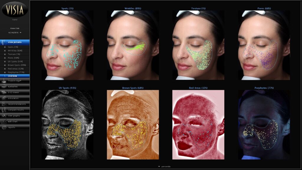vectra analisis facial con imagenes 3d